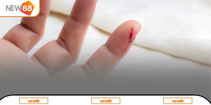 Sơ lược về chiêm bao thấy đứt tay